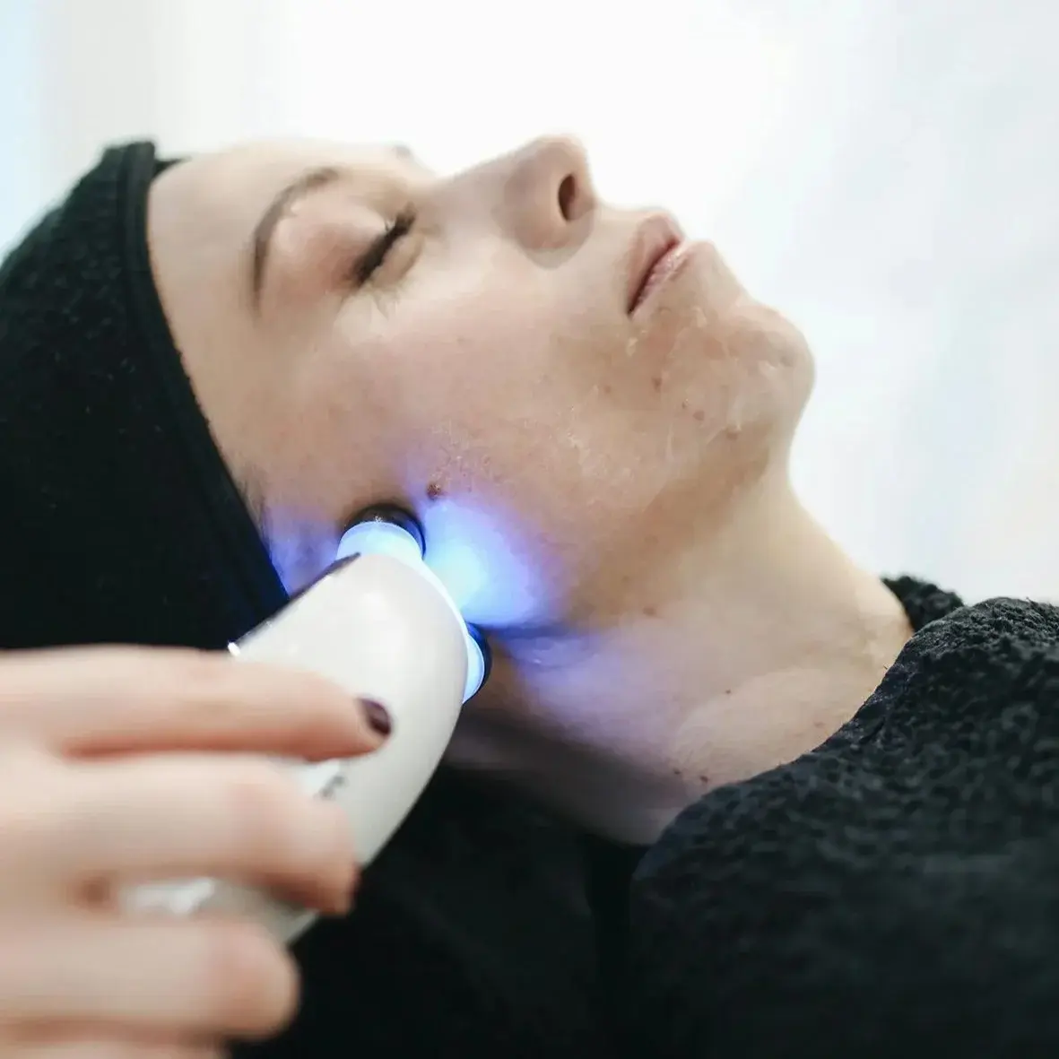 Traitement dermatologique de l’acné